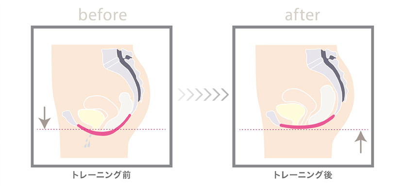 ペルーナ（Pelluna）とは？